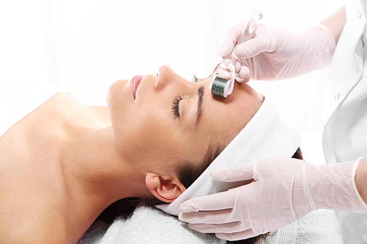 Preparations To Take Before a Microneedling Procedure