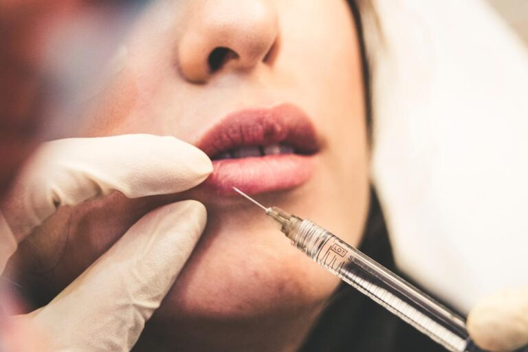 Dos and Don'ts After Getting a Lip Injection