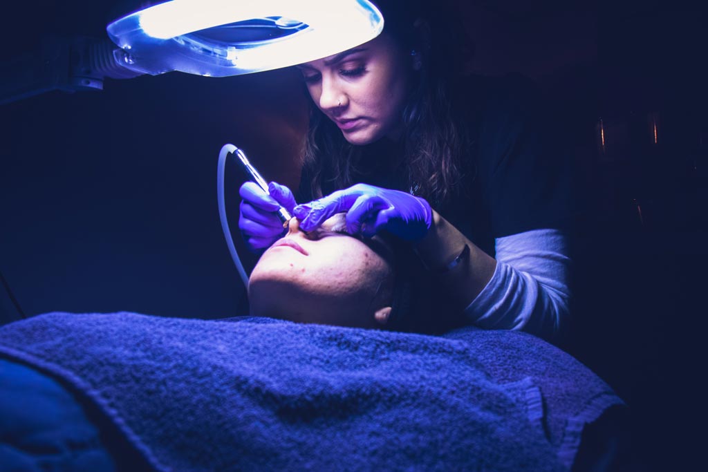 What is Microdermabrasion