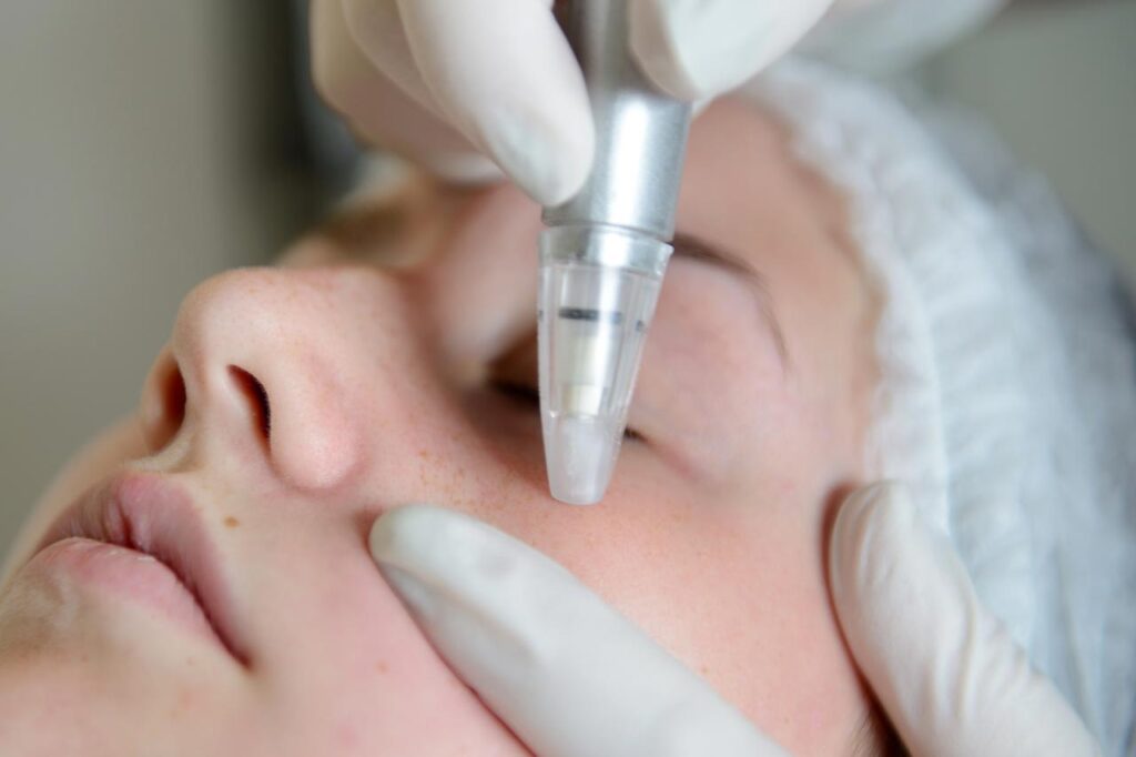 How To Tell If Microdermabrasion Is Right for You
