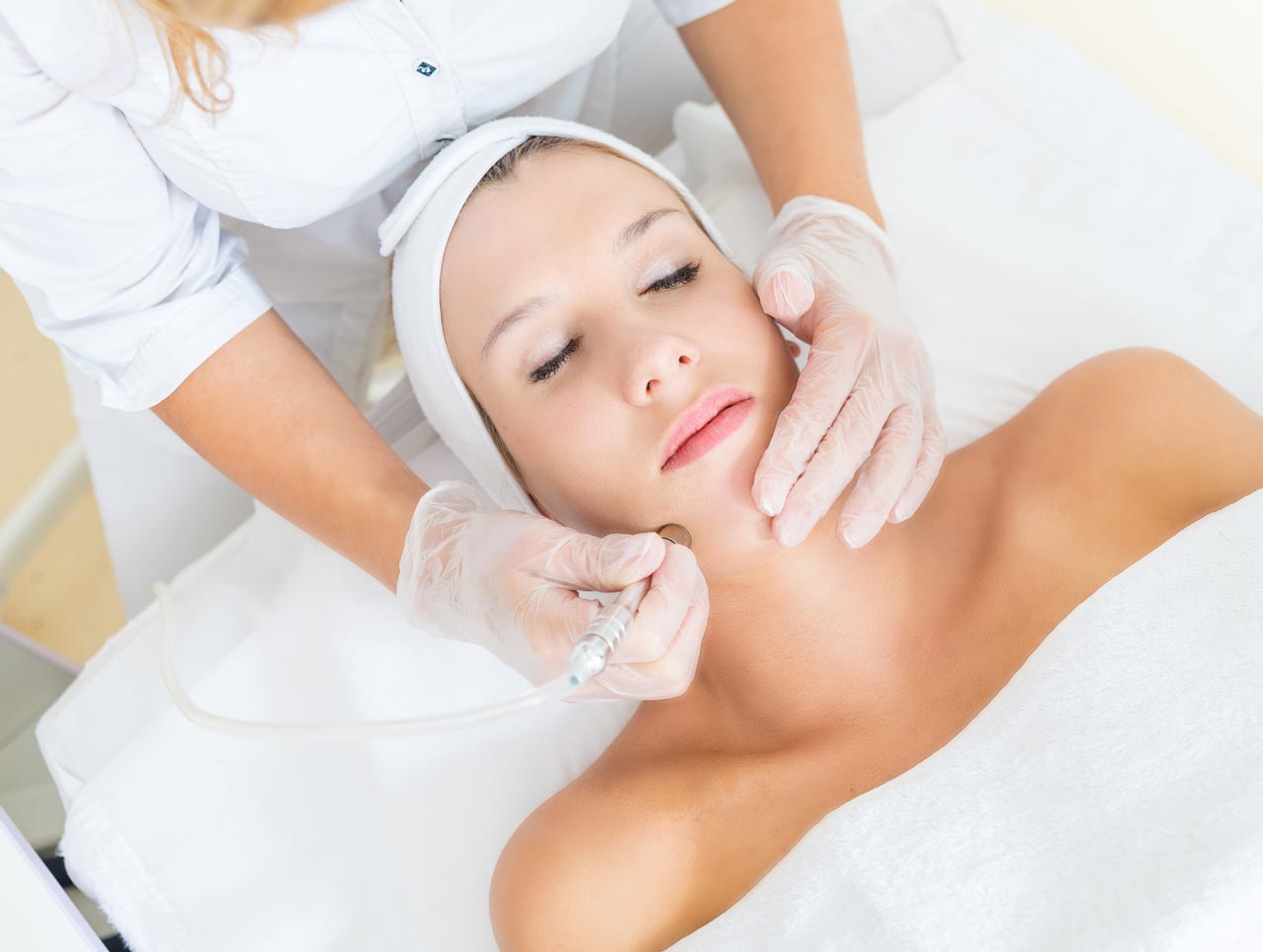 Does Microdermabrasion Get Rid of Peach Fuzz?