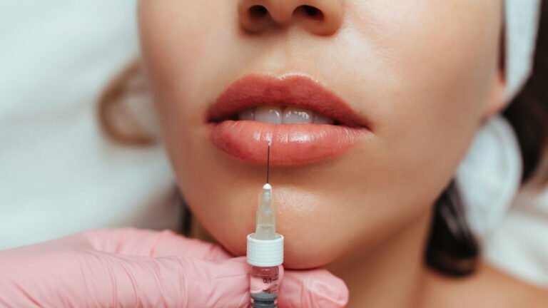 lip fillers boston
